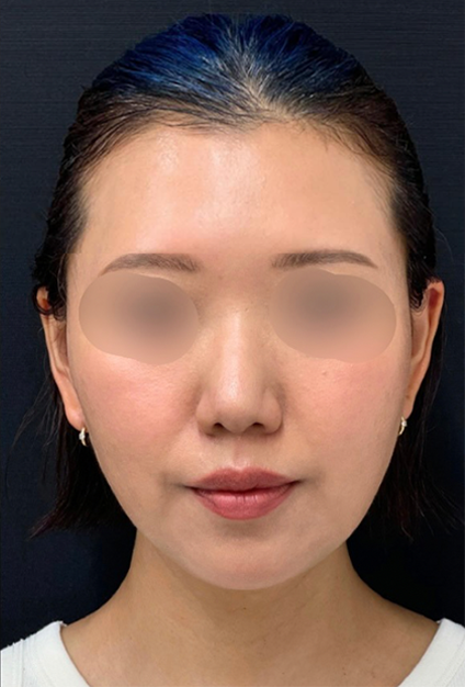 case2_after