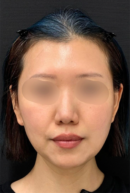 case2_before