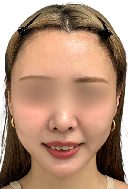 case4_after
