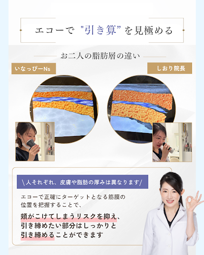 エコーを活用した照射