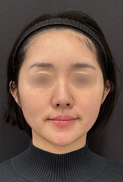 case2_after