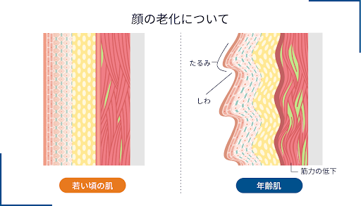 顔の老化について