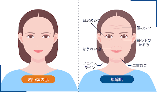 表情筋の老化でたるみやすい部位