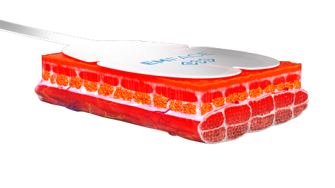 シンクロ波RF作用イメージ