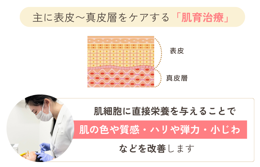 真皮層に作用する肌育治療