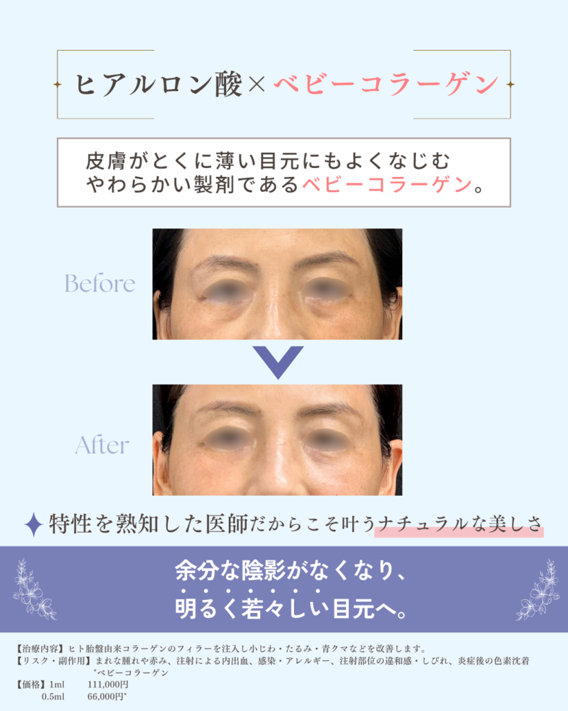 ココンベルのヒアルロン酸×ベビーコラーゲン