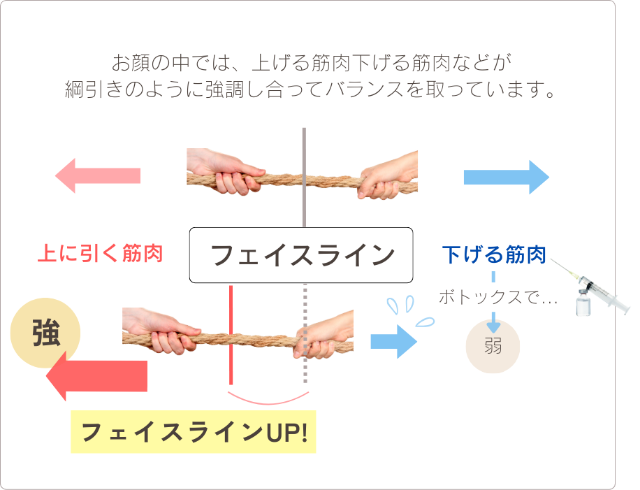 筋肉が上下にひっぱる力のイメージ